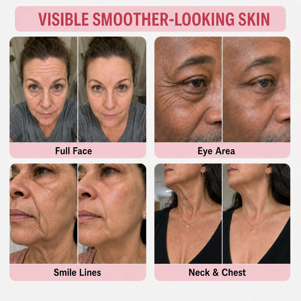MREVBSIN® |Botox-Inspired Pure Collagen Firming Wand