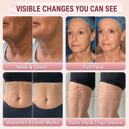 MREVBSIN® |Botox-Inspired Pure Collagen Firming Wand