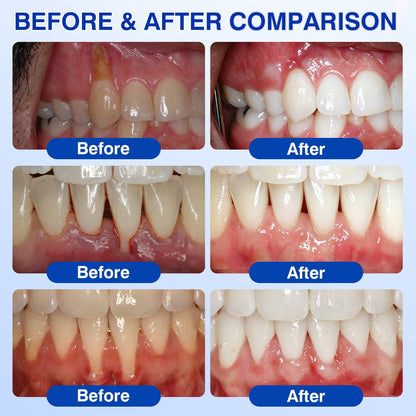 🏅🦷🛡️Jous® GumRevive Periodontal Repair Gel 💦