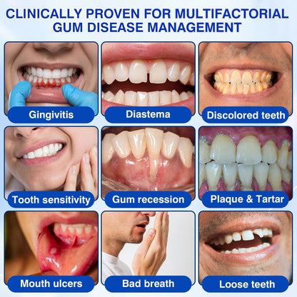 🏅🦷🛡️Jous® GumRevive Periodontal Repair Gel 💦