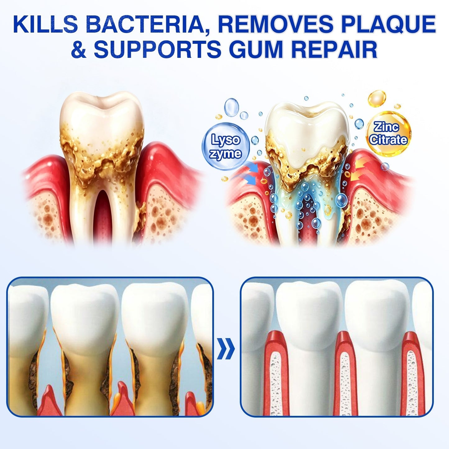 🏅🦷🛡️Jous® GumRevive Periodontal Repair Gel 💦