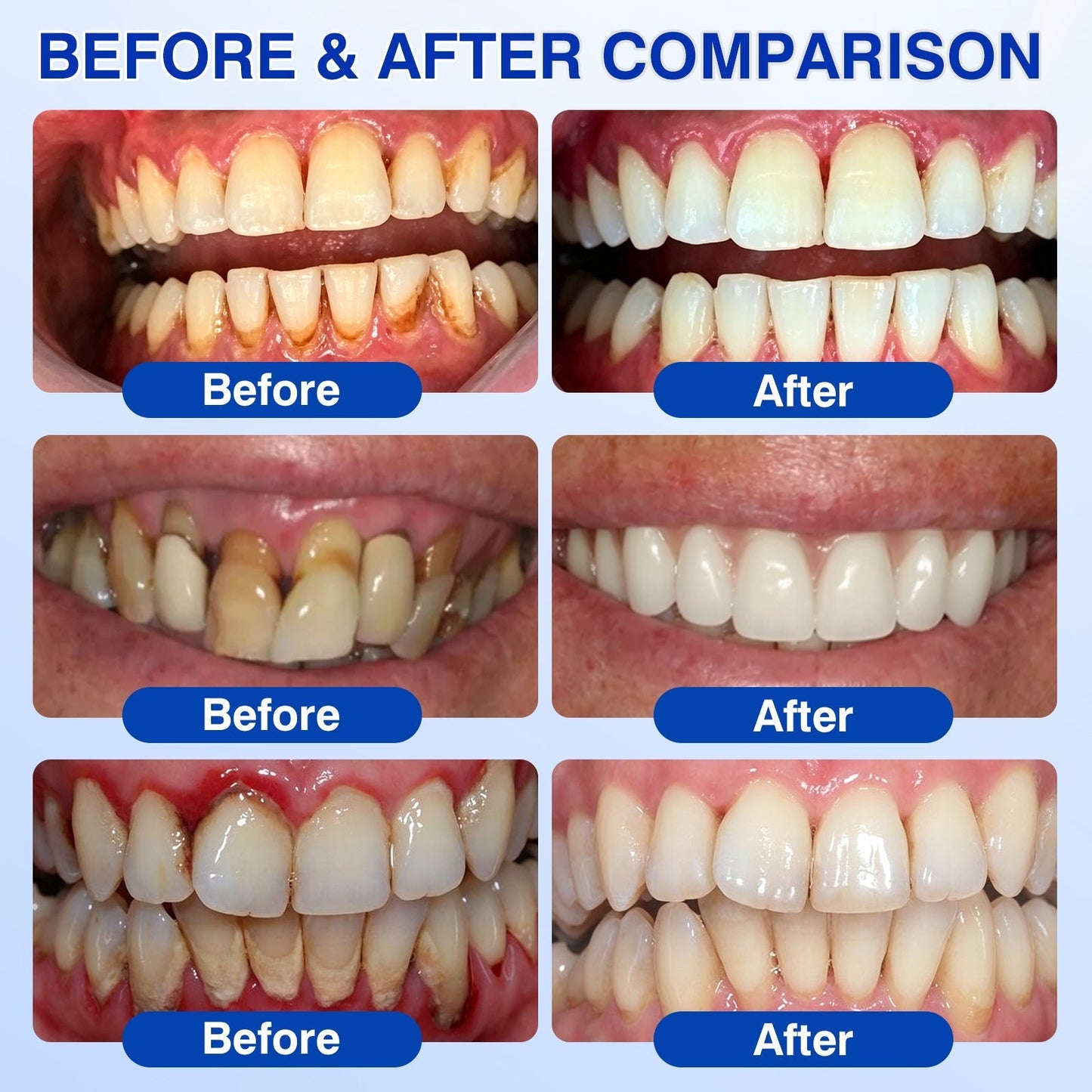 🏅🦷🛡️Jous® GumRevive Periodontal Repair Gel 💦