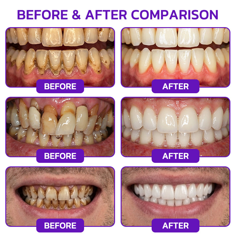 🦷🥇JOUS® VioCore Bee Venom Gingivitis & Periodontitis Treatment Toothpaste