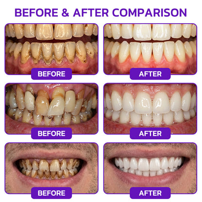 🦷🥇JOUS® VioCore Bee Venom Gingivitis & Periodontitis Treatment Toothpaste