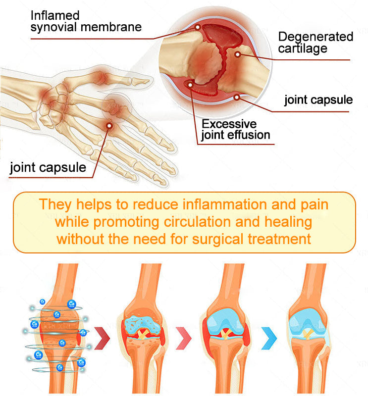 Healrize® Bee Venom Pain-Relief Bone Healing Cream 🇺🇸(Specially for older adults)