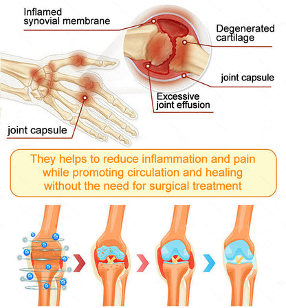 Healrize® Bee Venom Pain-Relief Bone Healing Cream 🇺🇸(Specially for older adults)
