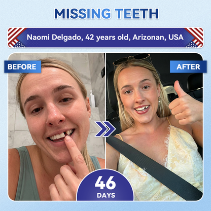 𝐏𝐡𝐲𝐬𝐢𝐜𝐢𝐚𝐧-𝐅𝐨𝐫𝐦𝐮𝐥𝐚𝐭𝐞𝐝 |𝐑𝐔𝐃𝐀𝐔𝐎® 𝟏𝟎-𝐈𝐍-𝟏 𝐀𝐝𝐯𝐚𝐧𝐜𝐞𝐝 𝐓𝐨𝐨𝐭𝐡 & 𝐆𝐮𝐦 𝐑𝐞𝐠𝐫𝐨𝐰𝐭𝐡 𝐌𝐢𝐜𝐫𝐨𝐧𝐞𝐞𝐝𝐥𝐞 𝐏𝐚𝐭𝐜𝐡