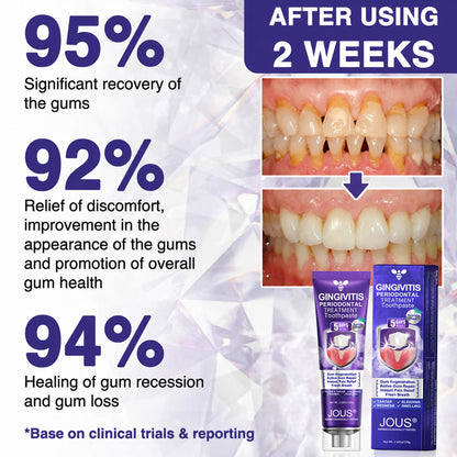 🦷JOUS® VioCore ✨ Bee Venom Gingivitis & Periodontitis Treatment Toothpaste