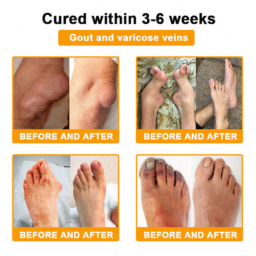 Healrize® Bee Venom Pain-Relief Bone Healing Cream 🇺🇸(Specially for older adults)