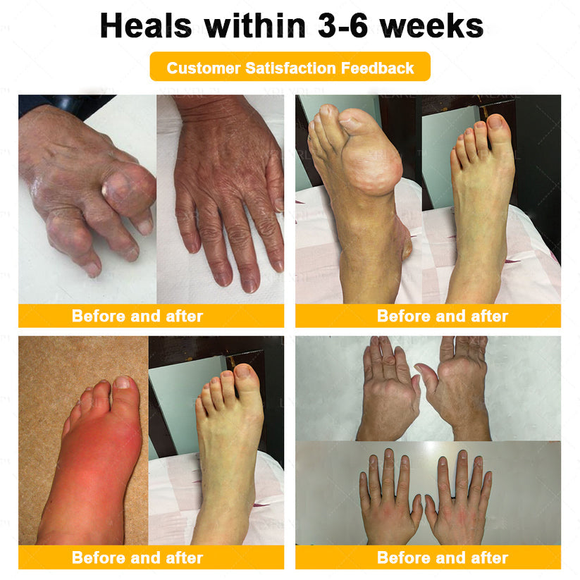 Healrize® Bee Venom Pain-Relief Bone Healing Cream 🇺🇸(Specially for older adults)