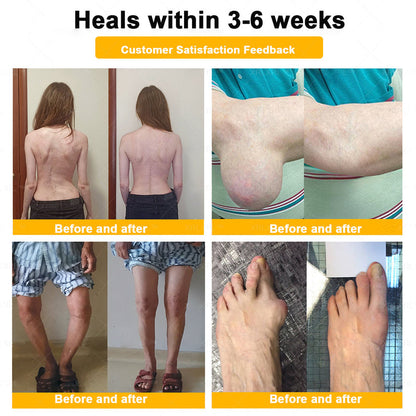 Healrize® Bee Venom Pain-Relief Bone Healing Cream 🇺🇸(Specially for older adults)