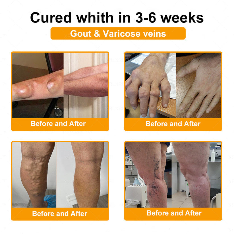 Healrize® Bee Venom Pain-Relief Bone Healing Cream 🇺🇸(Specially for older adults)