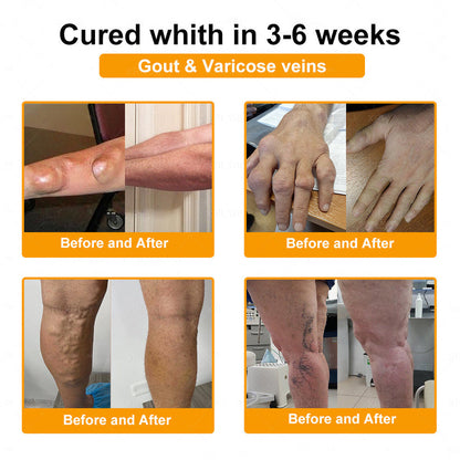 Healrize® Bee Venom Pain-Relief Bone Healing Cream 🇺🇸(Specially for older adults)