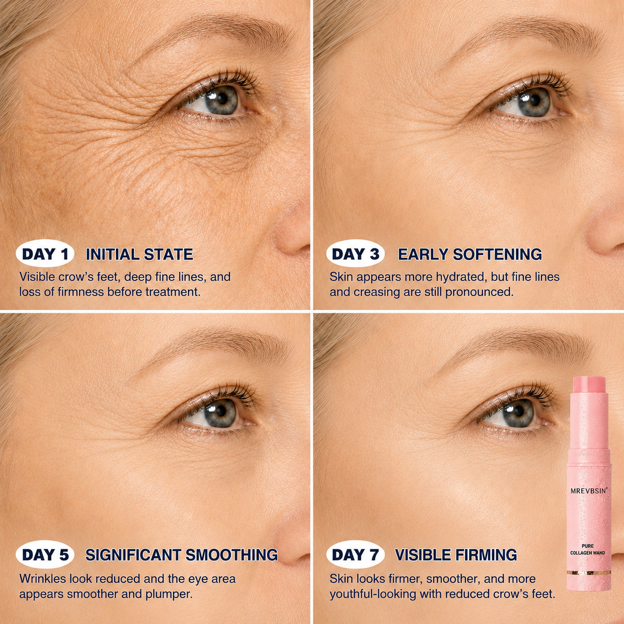 MREVBSIN® |Botox-Inspired Pure Collagen Firming Wand