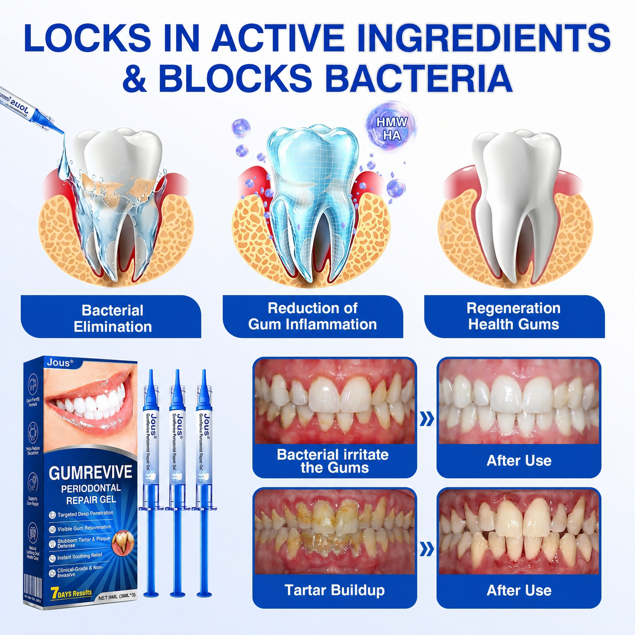 🏅🦷🛡️Jous® GumRevive Periodontal Repair Gel 💦