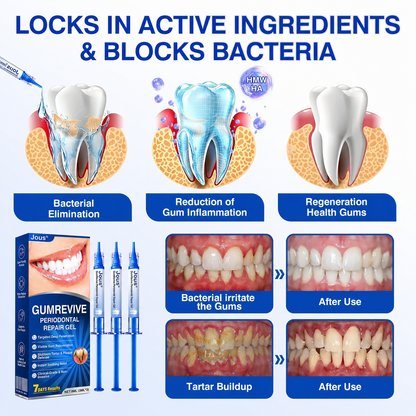 🏅🦷🛡️Jous® GumRevive Periodontal Repair Gel 💦