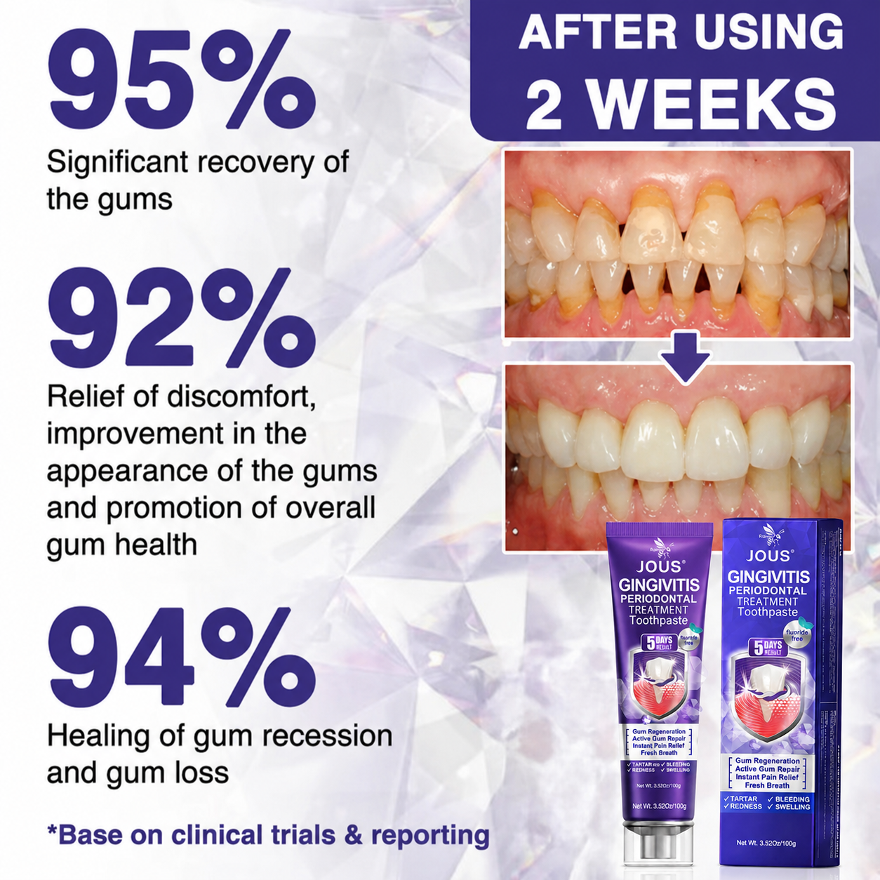 🦷🥇JOUS® VioCore Bee Venom Gingivitis & Periodontitis Treatment Toothpaste