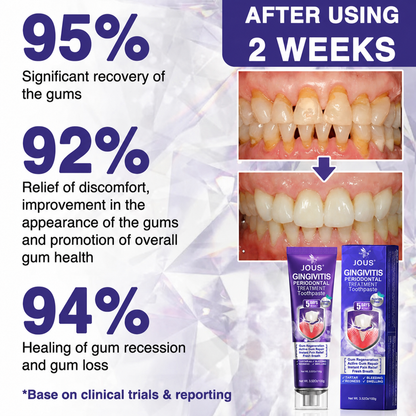 🦷🥇JOUS® VioCore Bee Venom Gingivitis & Periodontitis Treatment Toothpaste