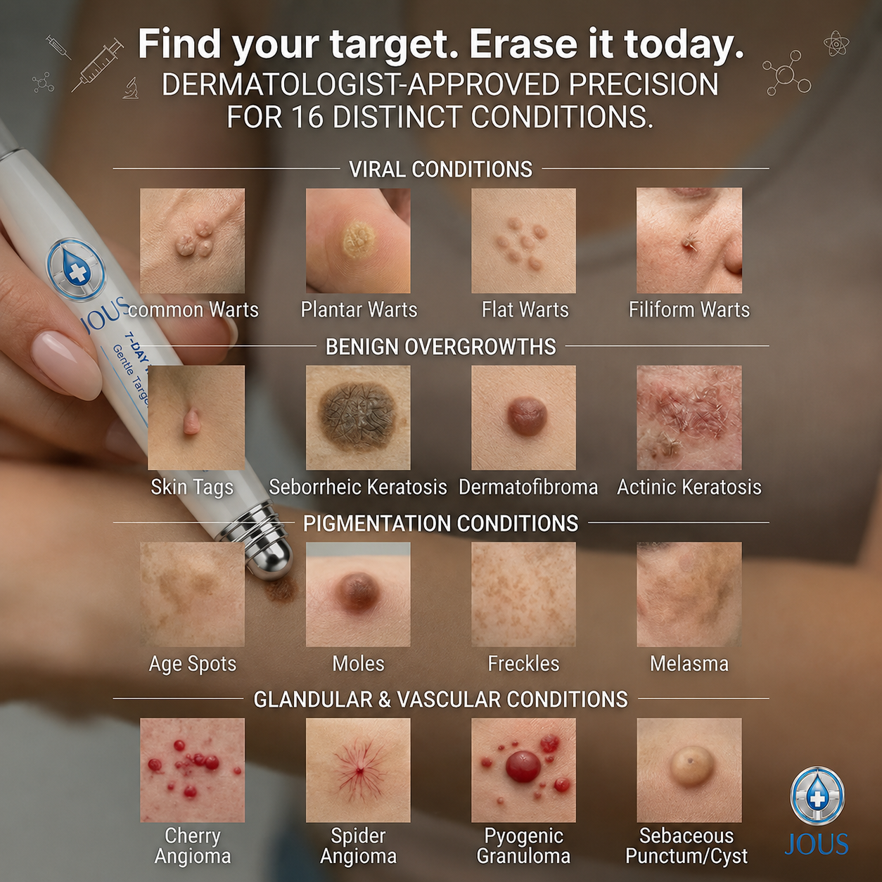 JOUS®👽 𝟕-𝐃𝒂𝘆 𝐒𝗸𝐢𝐧 𝐓𝒂𝗴 & 𝐒𝐩𝙤𝐭 𝐄𝐫𝒂𝐬𝙚𝐫 Painless & Scar-Free Advanced Imperfection Removal Rollerball Pen