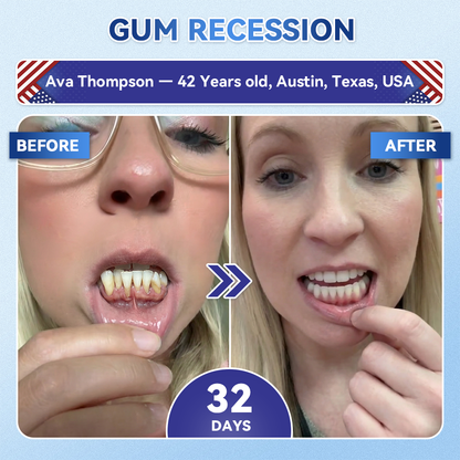 𝐏𝐡𝐲𝐬𝐢𝐜𝐢𝐚𝐧-𝐅𝐨𝐫𝐦𝐮𝐥𝐚𝐭𝐞𝐝 |𝐑𝐔𝐃𝐀𝐔𝐎® 𝟏𝟎-𝐈𝐍-𝟏 𝐀𝐝𝐯𝐚𝐧𝐜𝐞𝐝 𝐓𝐨𝐨𝐭𝐡 & 𝐆𝐮𝐦 𝐑𝐞𝐠𝐫𝐨𝐰𝐭𝐡 𝐌𝐢𝐜𝐫𝐨𝐧𝐞𝐞𝐝𝐥𝐞 𝐏𝐚𝐭𝐜𝐡