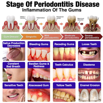 🦷🥇JOUS® VioCore Bee Venom Gingivitis & Periodontitis Treatment Toothpaste